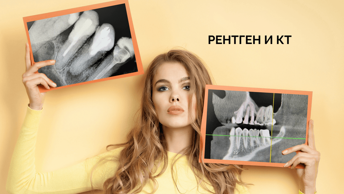 Что лучше: рентген зубов или КТ?